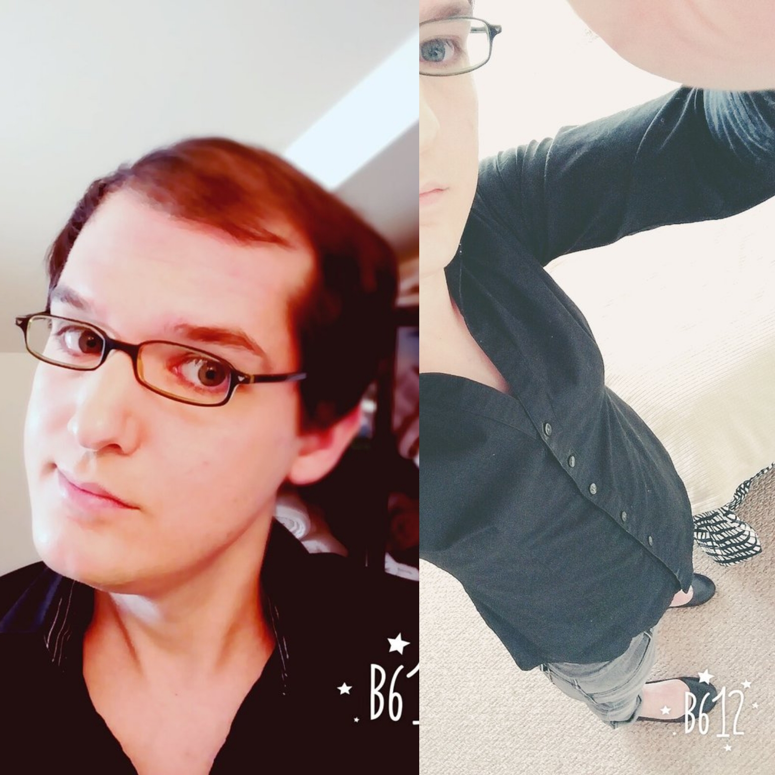 亮瞎眼!男子服用雌激素一年 抠脚大汉变娇娘