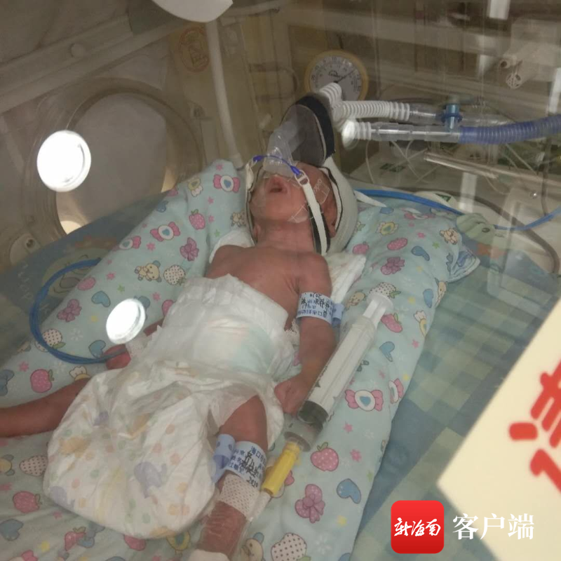 海口一女子怀孕27周胎膜早破 双胞胎早产呼吸衰竭盼救助